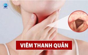 viêm thanh quản