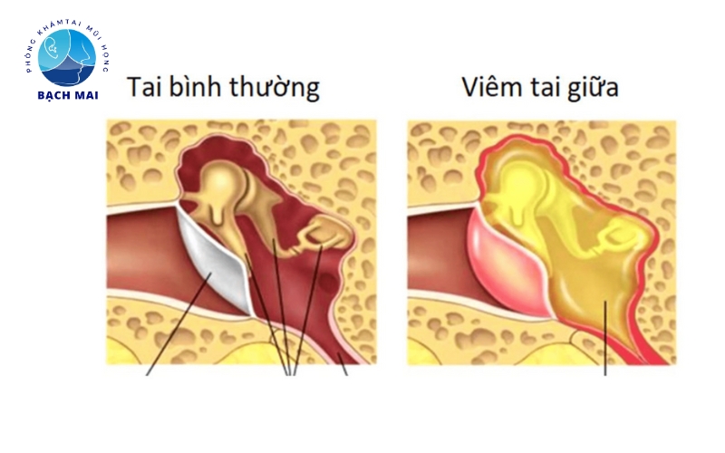 dich vu kham tai mui hong tre em 3