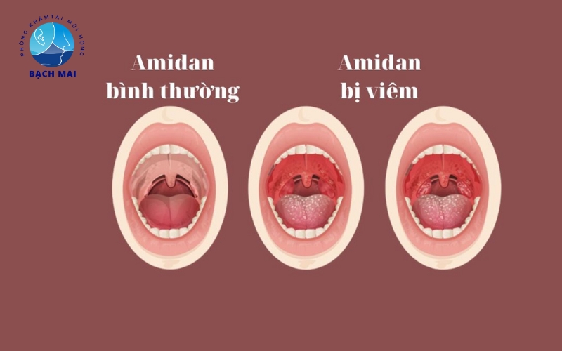 dich vu kham tai mui hong tre em 4