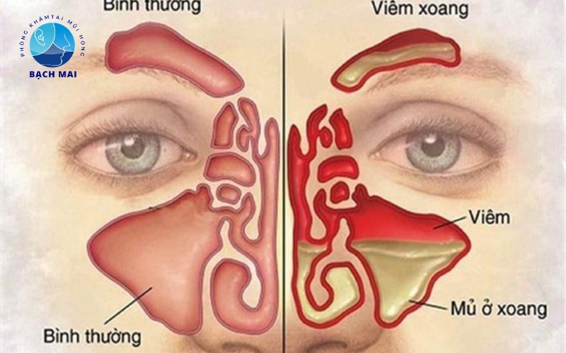 dich vu kham tai mui hong tre em 5